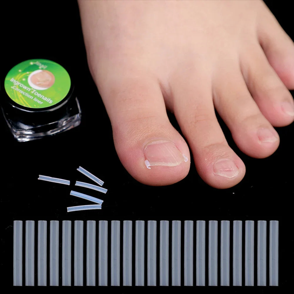 Toe Nail Support Pad