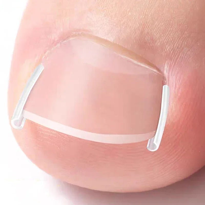 Toe Nail Support Pad