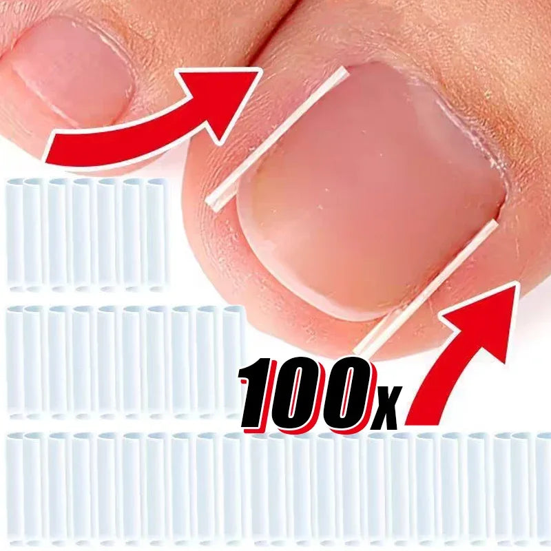 Toe Nail Support Pad